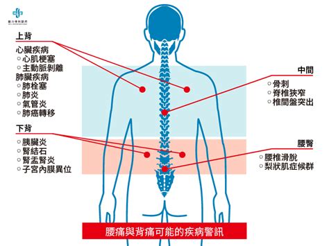 頭背|腰背痛全解析；上背痛、中背痛、下背痛、腰痛，圖解。